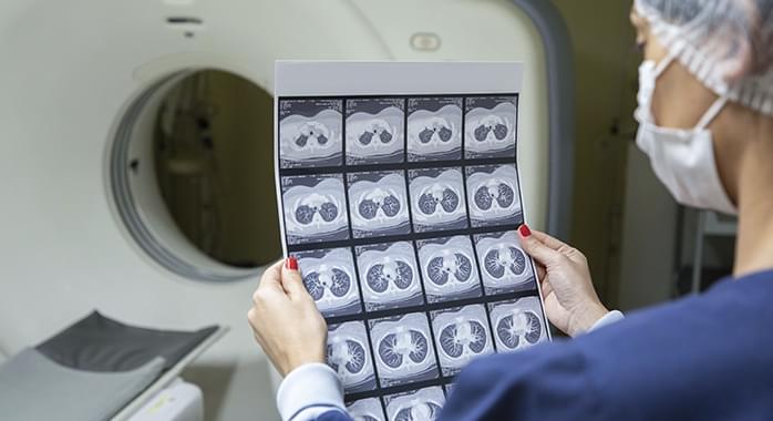 Radiologia Cascavel  RESSONÂNCIA MAGNÉTICA